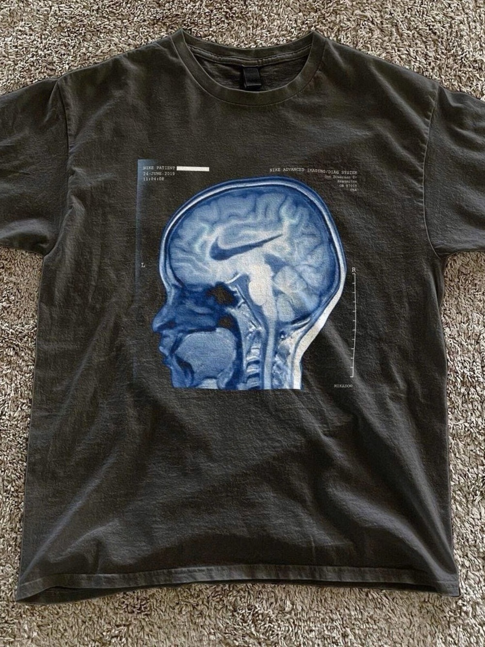 Gildan Black T-Shirt with Blue Brain MRI Graphic